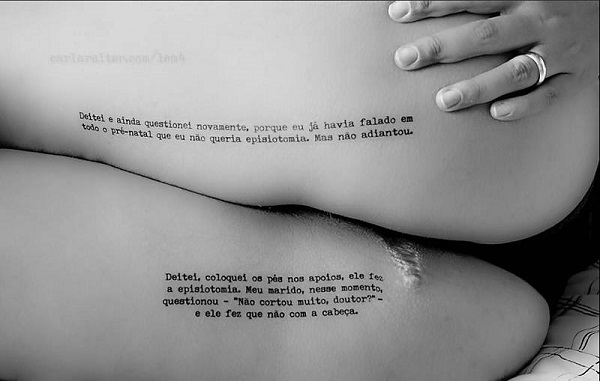 Mulher mostra a cicatriz sofrida durante o parto em uma episiotomia. Foto de Carla Raiter, que junto com Caroline Ferreira organiza o projeto 1:4 - Retratos da Violência Obstétrica.